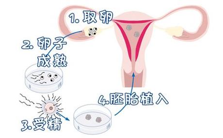 供卵去哪里做比较好【供卵去哪里做比较好？选择最佳供卵地点的指南】