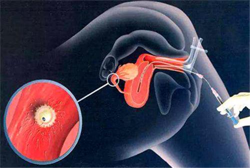 供卵生殖中心【供卵生殖中心：助您实现生育梦想】