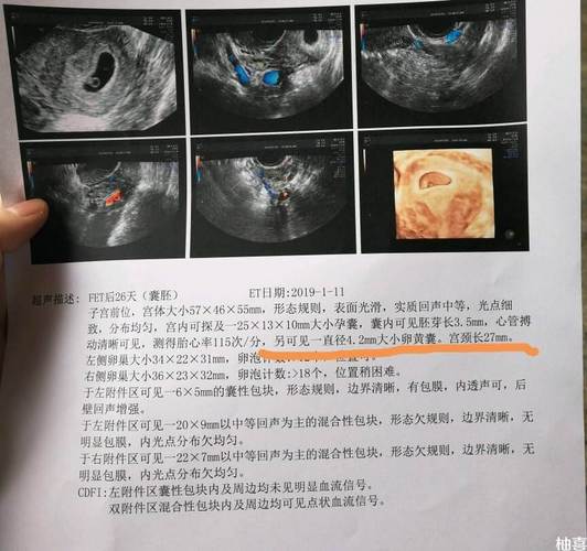 供卵的成功率有多大(供卵成功率有多大？)