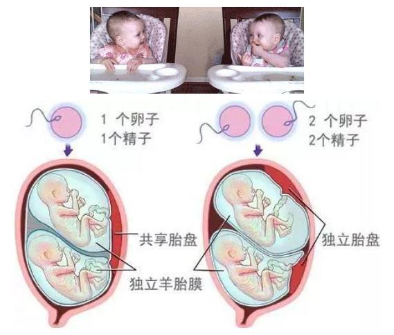 供卵试管代怀包双胞胎-双胞胎梦想实现供卵试管代怀包双胞胎助你圆梦